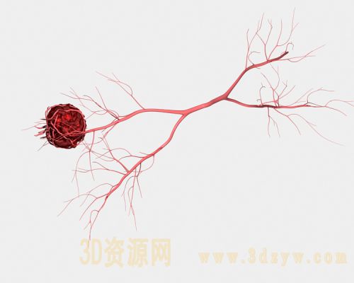 血管瘤3d模型 血管瘤模型 血管模型